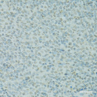 Immunohistochemistry of paraffin-embedded Rat spleen using SAFB Polyclonal Antibody at dilution of 1:100 (40x lens) .