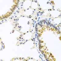 Immunohistochemistry of paraffin-embedded Rat lung using WNT9A Polyclonal Antibody at dilution of 1:100 (40x lens) .