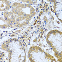 Immunohistochemistry of paraffin-embedded Human stomach using WNT9A Polyclonal Antibody at dilution of 1:100 (40x lens) .