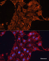Immunofluorescence analysis of C6 cells using ADAM12 Polyclonal Antibody at dilution of 1:100. Blue: DAPI for nuclear staining.