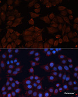 Immunofluorescence analysis of HeLa cells using ADAM12 Polyclonal Antibody at dilution of 1:100. Blue: DAPI for nuclear staining.
