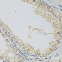 Immunohistochemistry of paraffin-embedded Human prostate using NAPA Polyclonal Antibody