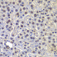 Immunohistochemistry of paraffin-embedded Mouse liver using FUBP3 Polyclonal Antibody at dilution of 1:100 (40x lens) .