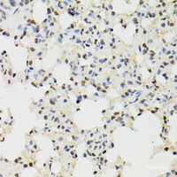 Immunohistochemistry of paraffin-embedded Mouse lung using KDM4A Polyclonal Antibody at dilution of 1:100 (40x lens) .