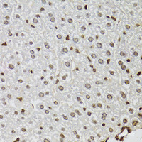 Immunohistochemistry of paraffin-embedded Mouse liver using KDM4A Polyclonal Antibody at dilution of 1:100 (40x lens) .