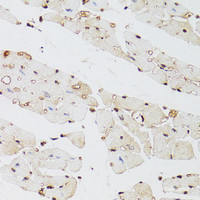 Immunohistochemistry of paraffin-embedded Mouse heart using KDM4A Polyclonal Antibody at dilution of 1:100 (40x lens) .