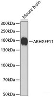 Western blot analysis of extracts of Mouse brain using ARHGEF11 Polyclonal Antibody at dilution of 1:1000.