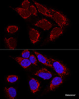 Confocal immunofluorescence analysis of U2OS cells using MTX2 Polyclonal Antibody at dilution of 1:100. Blue: DAPI for nuclear staining.