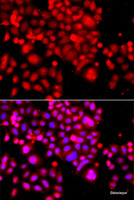 Immunofluorescence analysis of A549 cells using ASCC3 Polyclonal Antibody