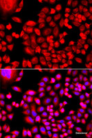 Immunofluorescence analysis of A549 cells using MTHFD1L Polyclonal Antibody