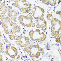 Immunohistochemistry of paraffin-embedded Human stomach using B9D1 Polyclonal Antibody at dilution of 1:100 (40x lens) .