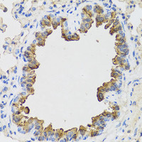 Immunohistochemistry of paraffin-embedded Mouse lung using B9D1 Polyclonal Antibody at dilution of 1:100 (40x lens) .