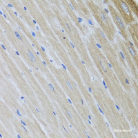 Immunohistochemistry of paraffin-embedded Mouse heart using USP25 Polyclonal Antibody at dilution of 1:100 (40x lens) .