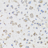 Immunohistochemistry of paraffin-embedded Mouse brain using USP25 Polyclonal Antibody at dilution of 1:100 (40x lens) .