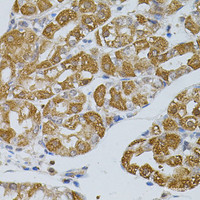 Immunohistochemistry of paraffin-embedded Human stomach using ASAH2 Polyclonal Antibody