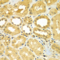 Immunohistochemistry of paraffin-embedded Human kidney using CALCOCO1 Polyclonal Antibody at dilution of 1:100 (40x lens) .