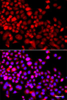 Immunofluorescence analysis of A549 cells using CALCOCO1 Polyclonal Antibody