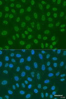 Immunofluorescence analysis of U2OS cells using LSM2 Polyclonal Antibody at dilution of 1:100. Blue: DAPI for nuclear staining.