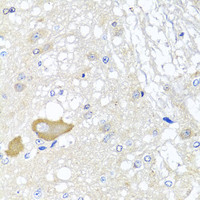 Immunohistochemistry of paraffin-embedded Rat brain using MCCC2 Polyclonal Antibody at dilution of 1:100 (40x lens) .