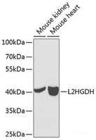 Western blot analysis of extracts of various cell lines using L2HGDH Polyclonal Antibody at dilution of 1:1000.