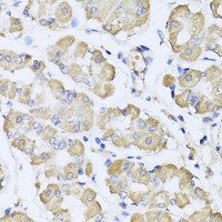 Immunohistochemistry of paraffin-embedded Human stomach using L2HGDH Polyclonal Antibody at dilution of 1:100 (40x lens) .