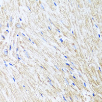 Immunohistochemistry of paraffin-embedded Mouse heart using L2HGDH Polyclonal Antibody at dilution of 1:100 (40x lens) .