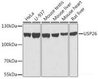 Western blot analysis of extracts of various cell lines using USP26 Polyclonal Antibody at dilution of 1:1000.