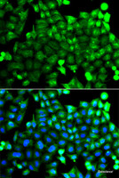 Immunofluorescence analysis of A549 cells using NCALD Polyclonal Antibody