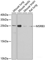 Western blot analysis of extracts of various cell lines using MSRB3 Polyclonal Antibody at dilution of 1:1000.
