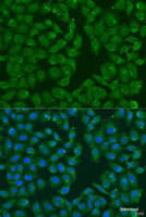 Immunofluorescence analysis of U2OS cells using MSRB3 Polyclonal Antibody at dilution of 1:100. Blue: DAPI for nuclear staining.
