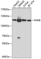 Western blot analysis of extracts of various cell lines using PHKB Polyclonal Antibody at dilution of 1:1000.