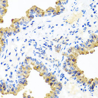 Immunohistochemistry of paraffin-embedded Mouse lung using PIP4K2B Polyclonal Antibody at dilution of 1:100 (40x lens) .