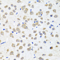 Immunohistochemistry of paraffin-embedded Mouse brain using PIP4K2B Polyclonal Antibody at dilution of 1:100 (40x lens) .