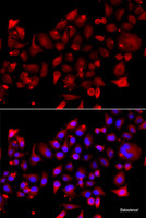 Immunofluorescence analysis of A549 cells using RRM2B Polyclonal Antibody