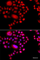 Immunofluorescence analysis of A549 cells using POLR1D Polyclonal Antibody