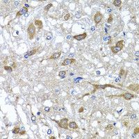 Immunohistochemistry of paraffin-embedded Rat brain using OSGEPL1 Polyclonal Antibody at dilution of 1:100 (40x lens) .