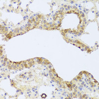 Immunohistochemistry of paraffin-embedded Mouse lung using PDK3 Polyclonal Antibody at dilution of 1:100 (40x lens) .