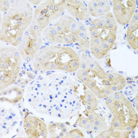 Immunohistochemistry of paraffin-embedded Rat kidney using PDK3 Polyclonal Antibody at dilution of 1:100 (40x lens) .