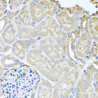 Immunohistochemistry of paraffin-embedded Mouse kidney using MYLK Polyclonal Antibody at dilution of 1:100 (40x lens) .