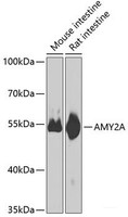 Western blot analysis of extracts of various cell lines using AMY2A Polyclonal Antibody at dilution of 1:1000.