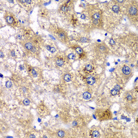 Immunohistochemistry of paraffin-embedded Human liver damage using AMY2A Polyclonal Antibody at dilution of 1:100 (40x lens) .