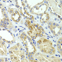 Immunohistochemistry of paraffin-embedded Human kidney using HMGCL Polyclonal Antibody at dilution of 1:100 (40x lens) .