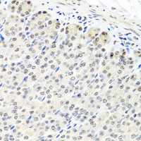 Immunohistochemistry of paraffin-embedded Mouse stomach using CNOT8 Polyclonal Antibody at dilution of 1:100 (40x lens) .