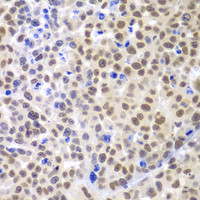 Immunohistochemistry of paraffin-embedded Mouse cancer using LHX4 Polyclonal Antibody at dilution of 1:100 (40x lens) .