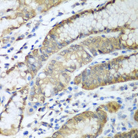 Immunohistochemistry of paraffin-embedded Human stomach using ADH1C Polyclonal Antibody at dilution of 1:100 (40x lens) .