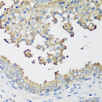 Immunohistochemistry of paraffin-embedded Human prostate using NEDD4L Polyclonal Antibody at dilution of 1:200 (40x lens) .