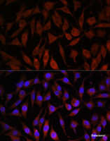 Immunofluorescence analysis of L929 cells using NEDD4L Polyclonal Antibody at dilution of 1:100. Blue: DAPI for nuclear staining.