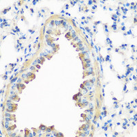 Immunohistochemistry of paraffin-embedded Mouse lung using CAV3 Polyclonal Antibody at dilution of 1:200 (40x lens) .