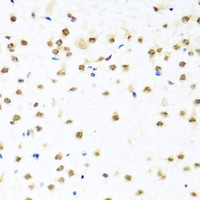 Immunohistochemistry of paraffin-embedded Mouse brain using RAB3IP Polyclonal Antibody at dilution of 1:100 (40x lens) .