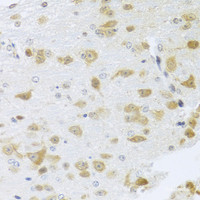 Immunohistochemistry of paraffin-embedded Mouse brain using Gm13125 Polyclonal Antibody at dilution of 1:100 (40x lens) .